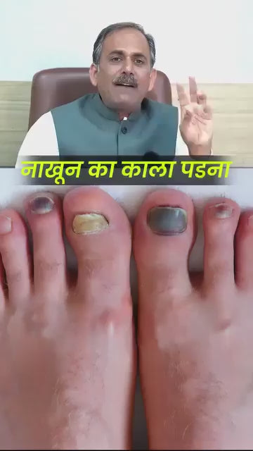 Onychomycosis Repair Bacteriostatic Liquid designed to treat fungal nail infections