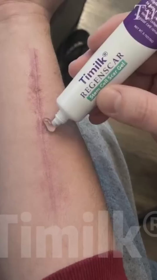 Scar Gel(Pack of 2)